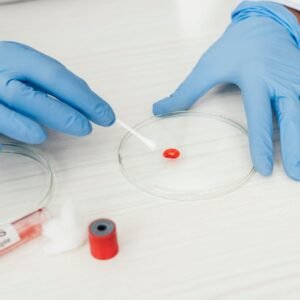 Kidney Function Test (KFT)